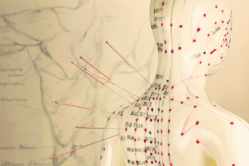 Fighting Cancer with Acupuncture and TCM