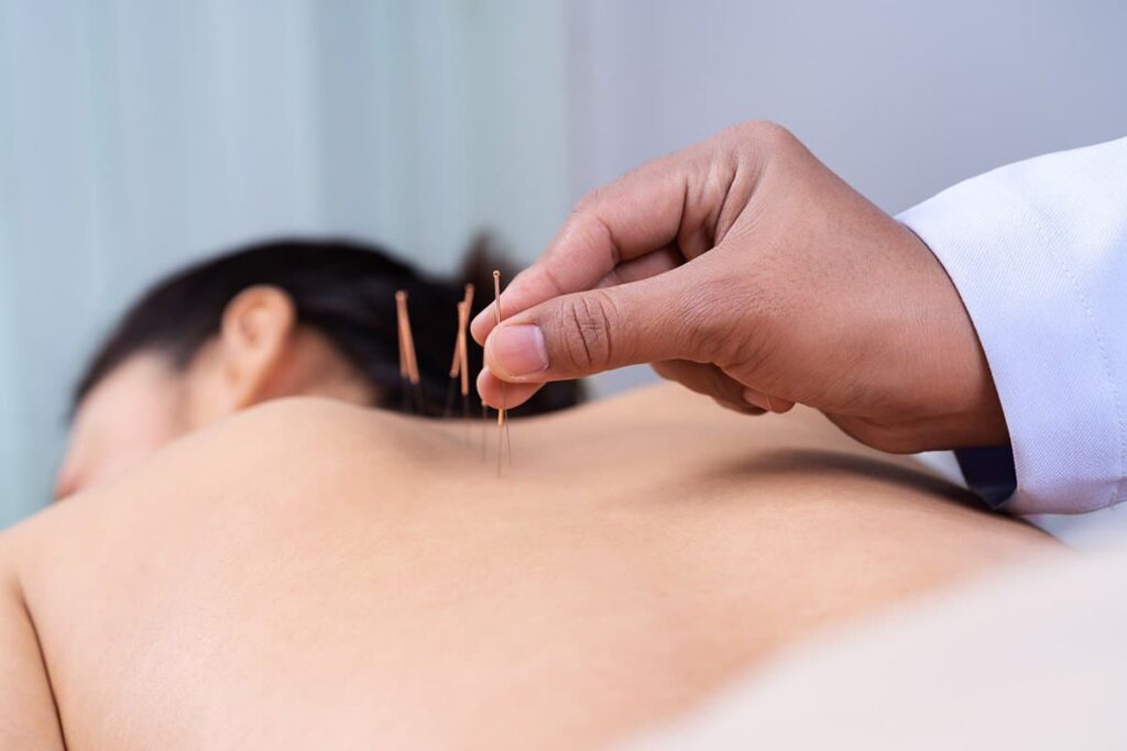 Warding Off Winter Blues: The Healing Touch of Acupuncture