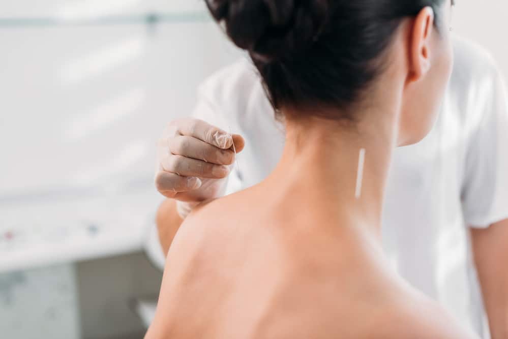 Acupuncture For Women’s Anxiety: Finding Peace in Ancient Wisdom