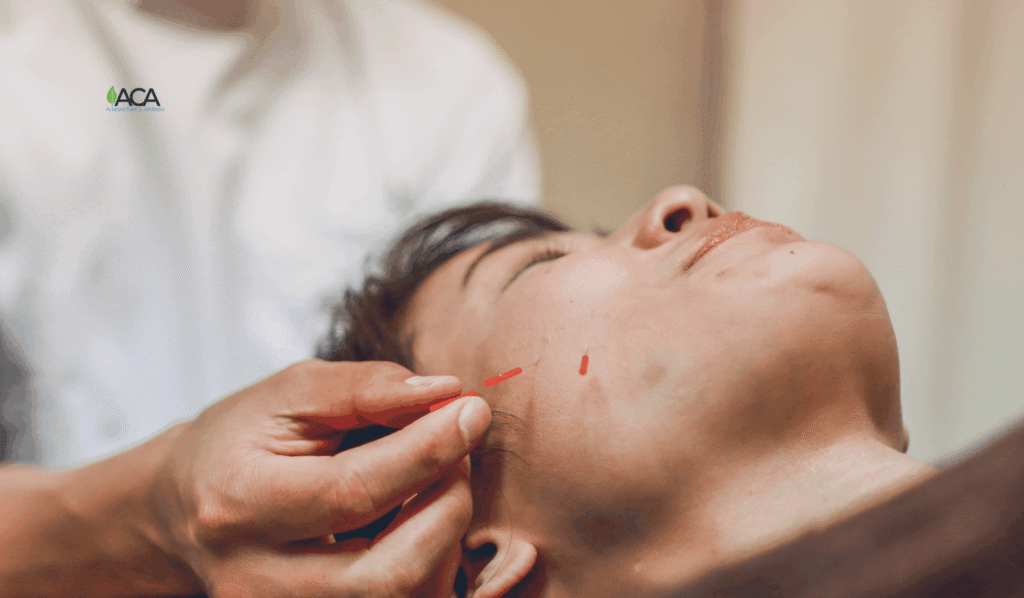 The Benefits Of Acupuncture For Overall Men’s Health