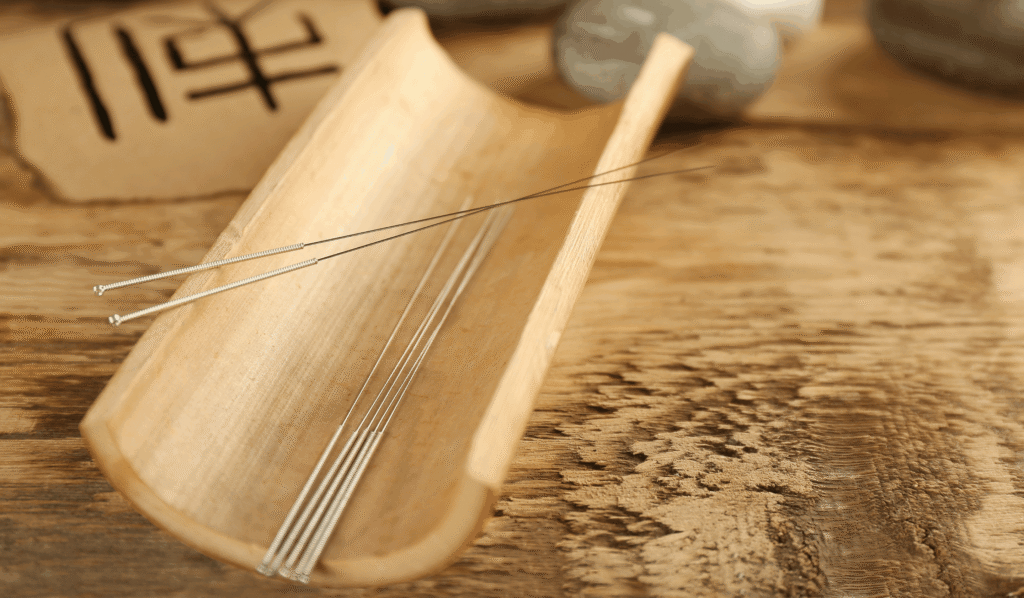 How Deep Do Acupuncture Needles Go? Depth Ranges, Anatomy, Safety, and What Patients Should Expect