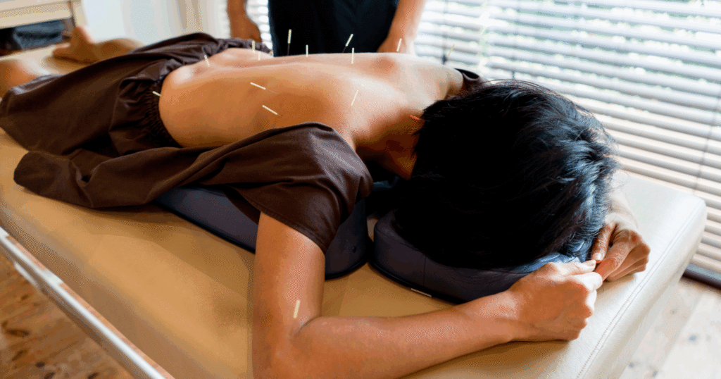 How Often Should You Get Acupuncture? Full Guide