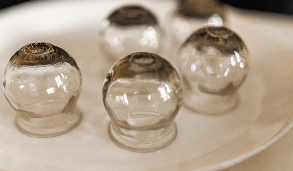 15 Proven Cupping Therapy Benefits