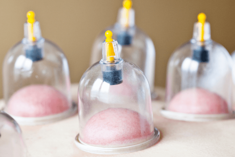 Wet Cupping vs Dry Cupping: Benefits, Risks, and Treatment Considerations